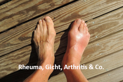 Beitrag "Rheuma, Gicht, Arthritis & Co." | menssensus® Institut Forschungsinstitut & menssensus Institut Therapiezentrum